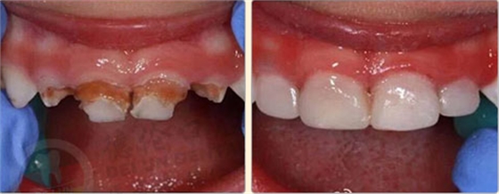 128-1P21014223R01.png 128-1P21014223R01.png