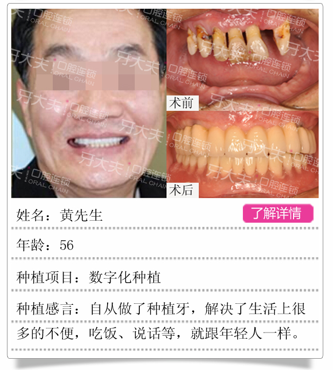 牙齿矫正手机版_08.png