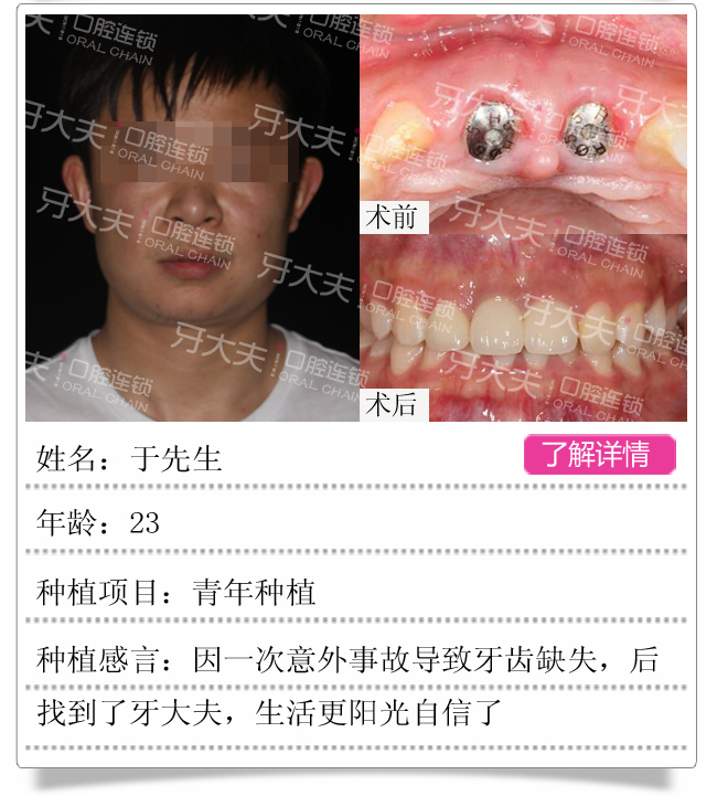 牙齿矫正手机版_10.png