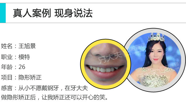牙齿矫正修_02.png