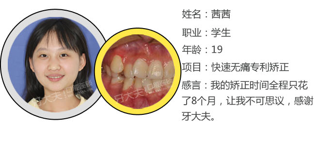 牙齿矫正修_03.png
